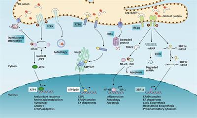 Endoplasmic reticulum stress associates with the development of intervertebral disc degeneration